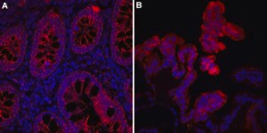 Anti-PEPCK from rabbit, purified by affinity chromatography