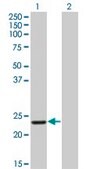 ANTI-RCV1 antibody produced in mouse clone 1D3, purified immunoglobulin, buffered aqueous solution