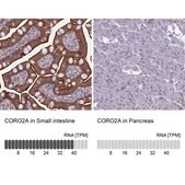 Anti-CORO2A antibody produced in rabbit Prestige Antibodies&#174; Powered by Atlas Antibodies, affinity isolated antibody, buffered aqueous glycerol solution