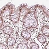 Anti-PLK1 antibody produced in rabbit Prestige Antibodies® Powered by Atlas Antibodies, affinity isolated antibody, buffered aqueous glycerol solution
