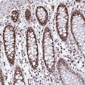 Anti-SLC35C2 antibody produced in rabbit Prestige Antibodies® Powered by Atlas Antibodies, affinity isolated antibody, buffered aqueous glycerol solution