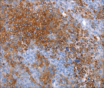 Anti-AQP5 antibody produced in rabbit affinity isolated antibody