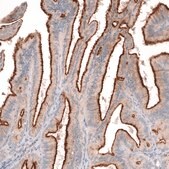 Monoclonal Anti-Msln Antibody Produced In Mouse Prestige Antibodies® Powered by Atlas Antibodies, clone CL13957, affinity isolated antibody, buffered aqueous glycerol solution