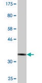 Monoclonal Anti-PRPH antibody produced in mouse clone 3B3, purified immunoglobulin, buffered aqueous solution