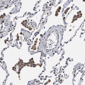 Anti-TRAF6 antibody produced in rabbit Prestige Antibodies&#174; Powered by Atlas Antibodies, affinity isolated antibody, buffered aqueous glycerol solution, Ab1