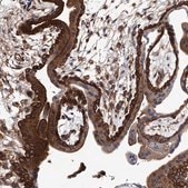 Anti-GAPVD1 antibody produced in rabbit Prestige Antibodies® Powered by Atlas Antibodies, affinity isolated antibody, buffered aqueous glycerol solution, ab1