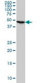 Monoclonal Anti-RP6-213H19.1, (C-terminal) antibody produced in mouse clone 7H4, purified immunoglobulin, buffered aqueous solution