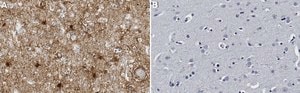 Anti-MARCKS Antibody, clone 1M14 ZooMAb&#174; Rabbit Monoclonal recombinant, expressed in HEK 293 cells