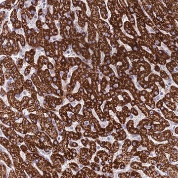 Anti-RNF222 antibody produced in rabbit Prestige Antibodies&#174; Powered by Atlas Antibodies, affinity isolated antibody, buffered aqueous glycerol solution