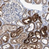 抗-AGK 兔抗 Prestige Antibodies&#174; Powered by Atlas Antibodies, affinity isolated antibody, buffered aqueous glycerol solution