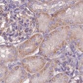 Anti-ADD1 antibody produced in rabbit Prestige Antibodies&#174; Powered by Atlas Antibodies, affinity isolated antibody, buffered aqueous glycerol solution