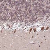 Anti-TMEM246 antibody produced in rabbit Prestige Antibodies® Powered by Atlas Antibodies, affinity isolated antibody, buffered aqueous glycerol solution