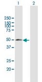Anti-YBX2 antibody produced in mouse purified immunoglobulin, buffered aqueous solution