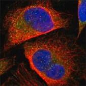 Anti-SLC7A2 antibody produced in rabbit Prestige Antibodies® Powered by Atlas Antibodies, affinity isolated antibody, buffered aqueous glycerol solution