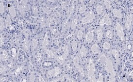 抗-KRas抗体，克隆2J13，ZooMAb&#174;兔单克隆抗体 recombinant, expressed in HEK 293 cells