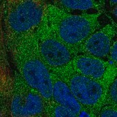 Anti-AAR2 antibody produced in rabbit Prestige Antibodies&#174; Powered by Atlas Antibodies, affinity isolated antibody, buffered aqueous glycerol solution