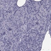 Anti-GKAP1 Prestige Antibodies&#174; Powered by Atlas Antibodies, affinity isolated antibody