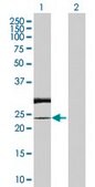 Anti-RAB7L1 antibody produced in rabbit purified immunoglobulin, buffered aqueous solution