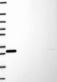 Anti-Kat5 Antibody Produced In Rabbit Prestige Antibodies&#174; Powered by Atlas Antibodies, affinity isolated antibody, buffered aqueous glycerol solution