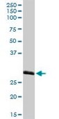 Anti-MED27 antibody produced in rabbit purified immunoglobulin, buffered aqueous solution