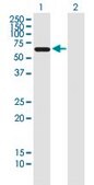 Monoclonal Anti-AAAS antibody produced in mouse clone 5A1, purified immunoglobulin, buffered aqueous solution