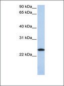 Anti-FTL affinity isolated antibody