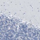 Anti-ASIC5 antibody produced in rabbit Prestige Antibodies® Powered by Atlas Antibodies, affinity isolated antibody, buffered aqueous glycerol solution