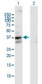 Anti-SLC25A3 antibody produced in mouse IgG fraction of antiserum, buffered aqueous solution