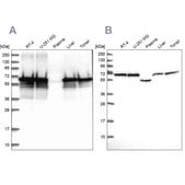 Anti-STIP1 antibody produced in rabbit Prestige Antibodies&#174; Powered by Atlas Antibodies, affinity isolated antibody, buffered aqueous glycerol solution