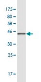 Monoclonal Anti-RLF antibody produced in mouse clone 2G2, purified immunoglobulin, buffered aqueous solution