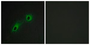 Anti-CAMK5 antibody produced in rabbit affinity isolated antibody