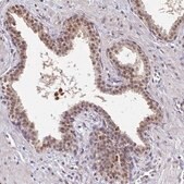 Anti-TMED5 antibody produced in rabbit Prestige Antibodies&#174; Powered by Atlas Antibodies, affinity isolated antibody, buffered aqueous glycerol solution