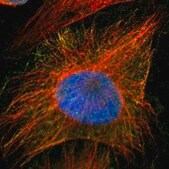 Anti-PRMT5 antibody produced in rabbit Prestige Antibodies&#174; Powered by Atlas Antibodies, affinity isolated antibody, buffered aqueous glycerol solution