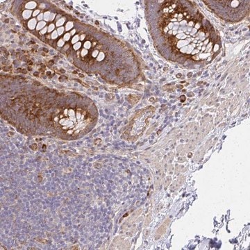 Anti-SGK494 antibody produced in rabbit Prestige Antibodies&#174; Powered by Atlas Antibodies, affinity isolated antibody, buffered aqueous glycerol solution