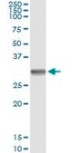 Monoclonal Anti-SNAI1 antibody produced in mouse clone 1A5, purified immunoglobulin, buffered aqueous solution