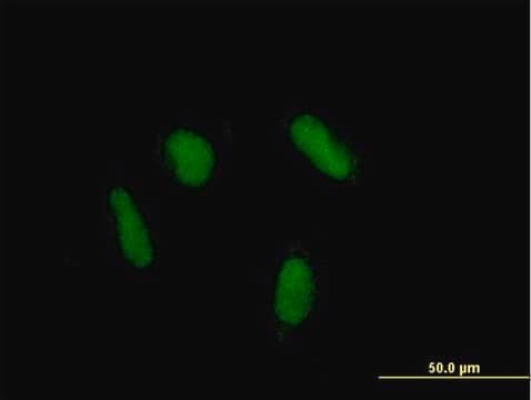 Anti-ZNF436 antibody produced in mouse purified immunoglobulin, buffered aqueous solution