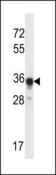 ANTI-ABHD4 (CENTER) antibody produced in rabbit affinity isolated antibody, buffered aqueous solution
