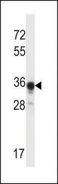 ANTI-ABHD4 (CENTER) antibody produced in rabbit affinity isolated antibody, buffered aqueous solution