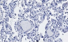 Anti-ACE2-extracellular Antibody, clone 1F21 ZooMAb® Rabbit Monoclonal recombinant, expressed in HEK 293 cells