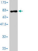 Monoclonal Anti-DDX6 antibody produced in mouse clone 3D2, purified immunoglobulin, buffered aqueous solution