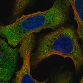 Anti-STRAP antibody produced in rabbit Prestige Antibodies&#174; Powered by Atlas Antibodies, affinity isolated antibody
