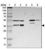 Anti-FAM110B antibody produced in rabbit Prestige Antibodies&#174; Powered by Atlas Antibodies, affinity isolated antibody, buffered aqueous glycerol solution
