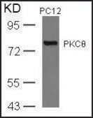 Anti-PRKCQ (Ab-676) antibody produced in rabbit affinity isolated antibody