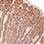 Anti-BCL2L14/BCLG antibody produced in rabbit