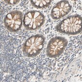 Anti-SMIM19 antibody produced in rabbit Prestige Antibodies® Powered by Atlas Antibodies, affinity isolated antibody, buffered aqueous glycerol solution