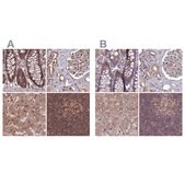 Anti-PSMB8 antibody produced in rabbit Prestige Antibodies® Powered by Atlas Antibodies, affinity isolated antibody, buffered aqueous glycerol solution