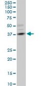 Monoclonal Anti-DMC1, (C-terminal) antibody produced in mouse clone 4A10, purified immunoglobulin, buffered aqueous solution