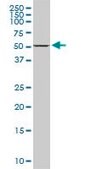 Monoclonal Anti-DDX56, (C-terminal) antibody produced in mouse clone 6B9, purified immunoglobulin, buffered aqueous solution