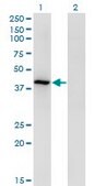 Monoclonal Anti-TMOD3, (C-terminal) antibody produced in mouse clone 1E1, purified immunoglobulin, buffered aqueous solution