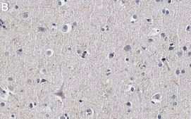 Anti-Tau Antibody, clone Tau 12 ZooMAb&#174; Mouse Monoclonal recombinant, expressed in HEK 293 cells